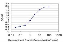 ERCC6L Antibody (3F12-2B10), Novus Biologicals 0.1 mg, Unconjugated:Antibodies,