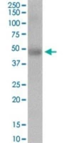 ERCC6L Antibody, Novus Biologicals 0.1 mg | Buy Online | Novus Biologicals | Fisher Scientific
