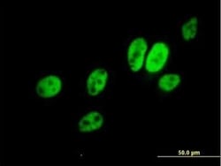ERCC8 Antibody, Novus Biologicals 0.05 mg | Buy Online | Novus Biologicals | Fisher Scientific