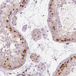 ERF Antibody, Novus Biologicals:Antibodies:Primary Antibodies