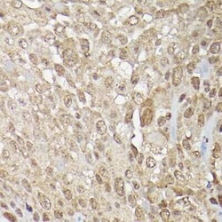 ERK1/2 Antibody - Azide and BSA Free, Novus Biologicals:Antibodies:Primary