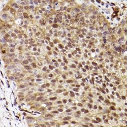 ERK1 Rabbit anti-Human, Mouse, Rat, Clone: 0B0C1, Novus Biologicals 100