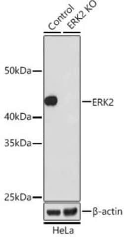 ERK2 Rabbit anti-Human, Mouse, Rat, Clone: 7I5L7, Novus Biologicals 100 &mu;g | Buy Online | Bio-Techne | Fisher Scientific