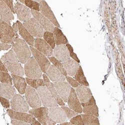 ERK2 Antibody, Novus Biologicals 25 &mu;L; Unconjugated:Antibodies, Polyclonal