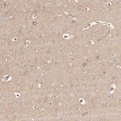 ERK2 Antibody, Novus Biologicals 25 &mu;L; Unconjugated:Antibodies, Polyclonal