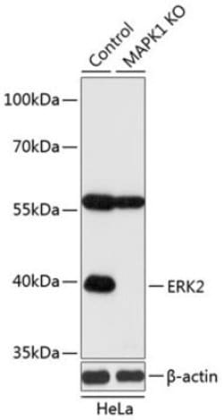 Vanilloid R-like 3/TRPV3 Rabbit anti-Human, Mouse, Rat, Polyclonal, Novus