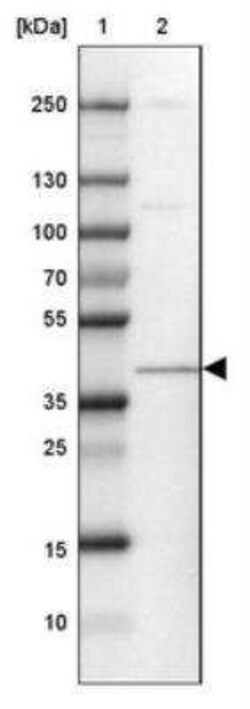 ERK2 Antibody, Novus Biologicals 25 &mu;L; Unconjugated:Antibodies, Polyclonal
