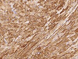 ERK3/MAPK6 Antibody, Novus Biologicals 50 &mu;g | Buy Online | Novus Biologicals | Fisher Scientific