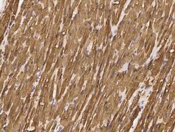 ERK3/MAPK6 Antibody, Novus Biologicals 50 &mu;g | Buy Online | Novus Biologicals | Fisher Scientific