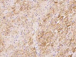 ERK3/MAPK6 Antibody, Novus Biologicals 50 &mu;g | Buy Online | Novus Biologicals | Fisher Scientific
