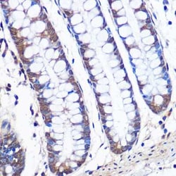 ERK5/BMK1 Rabbit anti-Human, Mouse, Rat, Clone: 5C1P5, Novus Biologicals