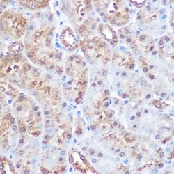 ERK5/BMK1 Rabbit anti-Human, Mouse, Rat, Clone: 5C1P5, Novus Biologicals