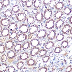ERK5/BMK1 Rabbit anti-Human, Mouse, Rat, Clone: 5C1P5, Novus Biologicals