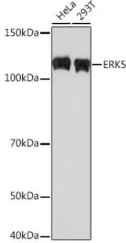 ERK5/BMK1 Rabbit anti-Human, Mouse, Rat, Clone: 5C1P5, Novus Biologicals