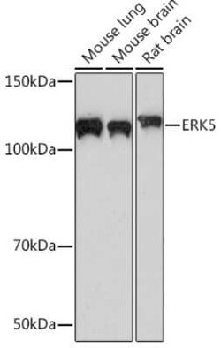 ERK5/BMK1 Rabbit anti-Human, Mouse, Rat, Clone: 5C1P5, Novus Biologicals