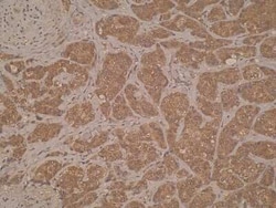 ERO1LB Antibody (M37-P5D11) - BSA Free, Novus Biologicals:Antibodies:Primary