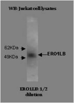 ERO1LB Antibody (M37-P5D11) - BSA Free, Novus Biologicals:Antibodies:Primary