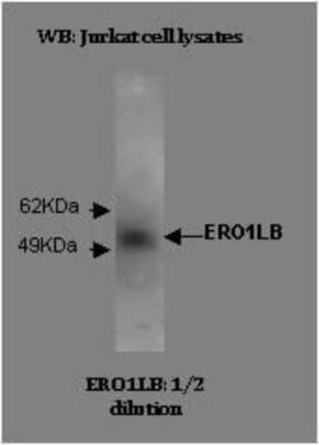 ERO1LB Antibody (M37-P5D11) - BSA Free, Novus Biologicals ERO1LB Antibody (M37-P5D11) - BSA Free, Novus Biologicals