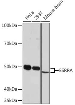 ERR alpha/NR3B1 Rabbit anti-Human, Mouse, Clone: 2R10S3, Novus Biologicals 100 &mu;g | Buy Online | Novus Biologicals | Fisher Scientific