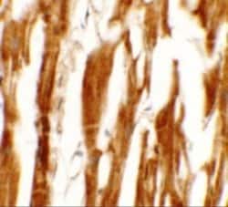 ERR beta/NR3B2 Antibody - BSA Free, Novus Biologicals 0.1 mg; Unconjugated:Antibodies,