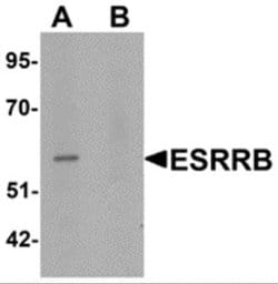 ERR beta/NR3B2 Antibody - BSA Free, Novus Biologicals 0.1 mg; Unconjugated:Antibodies,