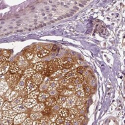 ERV3-1 Antibody, Novus Biologicals 25ul; Unconjugated:Antibodies, Polyclonal