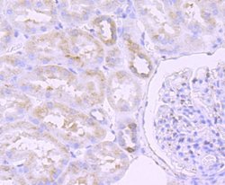 ERp57/PDIA3 Rabbit anti-Human, Clone: JM11-44, Novus Biologicals 100&mu;L:Antibodies,
