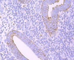 ERp57/PDIA3 Rabbit anti-Human, Clone: JM11-44, Novus Biologicals 100&mu;L:Antibodies,
