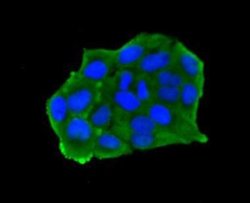 ESD Mouse anti-Human, Clone: J0-8, Novus Biologicals 100&mu;L:Antibodies,