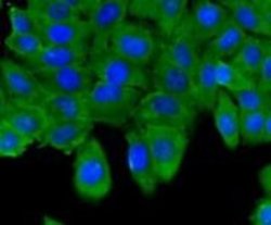 ESD Mouse anti-Human, Clone: J0-8, Novus Biologicals 100&mu;L:Antibodies,
