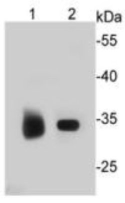 ESD Mouse anti-Human, Clone: J0-8, Novus Biologicals 100&mu;L:Antibodies,