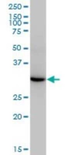 ESD Antibody (1E1), Novus Biologicals 0.1 mg | Buy Online | Novus Biologicals | Fisher Scientific