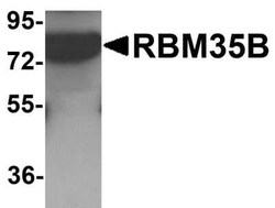 ESRP2 Antibody - BSA Free, Novus Biologicals 0.025 mg; Unconjugated:Antibodies,