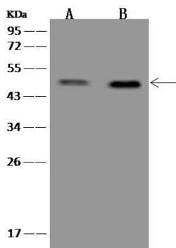 ESX1 Antibody, Novus Biologicals 100 &mu;g | Buy Online | Novus Biologicals | Fisher Scientific
