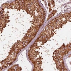 ETEA Antibody, Novus Biologicals 100 &mu;g; Unconjugated:Antikörper