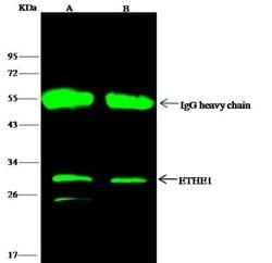 ETHE1 Rabbit anti-Human, Clone: 1, Novus Biologicals 50 &mu;g; Unconjugated:Antibodies,