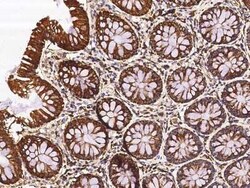 ETHE1 Antibody, Novus Biologicals 100 &mu;g | Buy Online | Novus Biologicals | Fisher Scientific