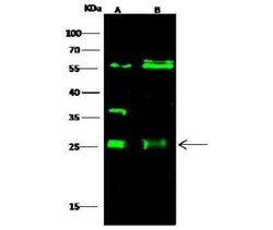 ETHE1 Antibody, Novus Biologicals 100 &mu;g | Buy Online | Novus Biologicals | Fisher Scientific