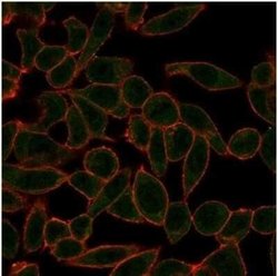 ETS2 Mouse anti-Human, Clone: PCRP-ETS2-1D9, Novus Biologicals:Antibodies:Primary