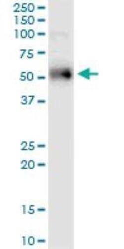 ETV1 Antibody (2A8), Novus Biologicals 0.1 mg | Buy Online | Novus Biologicals | Fisher Scientific