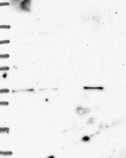 ETV1 Rabbit anti-Human, Polyclonal, Novus Biologicals 100 &mu;g; Unconjugated:Antibodies,
