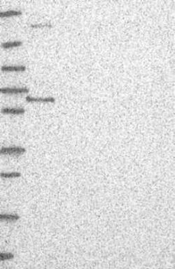 ETV3 Rabbit anti-Human, Polyclonal, Novus Biologicals:Antibodies:Primary