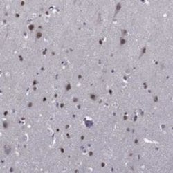 ETV5/ERM Rabbit anti-Human, Polyclonal, Novus Biologicals:Antibodies:Primary
