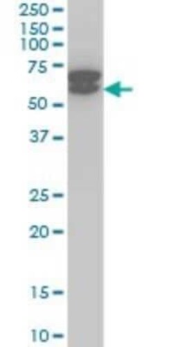 ETV6/Tel Antibody (3B10), Novus Biologicals 0.1 mg | Buy Online | Novus Biologicals | Fisher Scientific