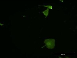 EVA1/MPZL2 Antibody (2E10), Novus Biologicals 0.1 mg | Buy Online | Novus Biologicals | Fisher Scientific
