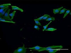 EVA1/MPZL2 Antibody (2E10), Novus Biologicals 0.1 mg | Buy Online | Novus Biologicals | Fisher Scientific