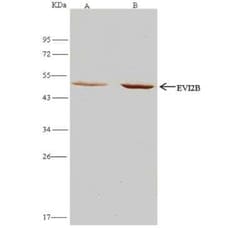EVI2B Antibody, Novus Biologicals 100 &mu;g, Unconjugated:Antibodies, Polyclonal