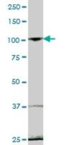 EVI5L Antibody, Novus Biologicals 0.05 mg | Buy Online | Novus Biologicals | Fisher Scientific