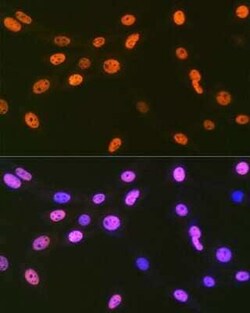 EWSR1 Rabbit anti-Human, Mouse, Rat, Clone: 9G3H1, Novus Biologicals 20