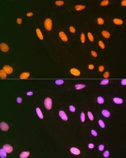 EWSR1 Rabbit anti-Human, Mouse, Rat, Clone: 9G3H1, Novus Biologicals 20